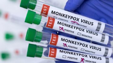 WHO confirms monkeypox spreads sexually in DR Congo amid outbreak