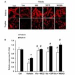 Membrane raft redox signaling contributes to visfatin-induced inflammation and kidney damage