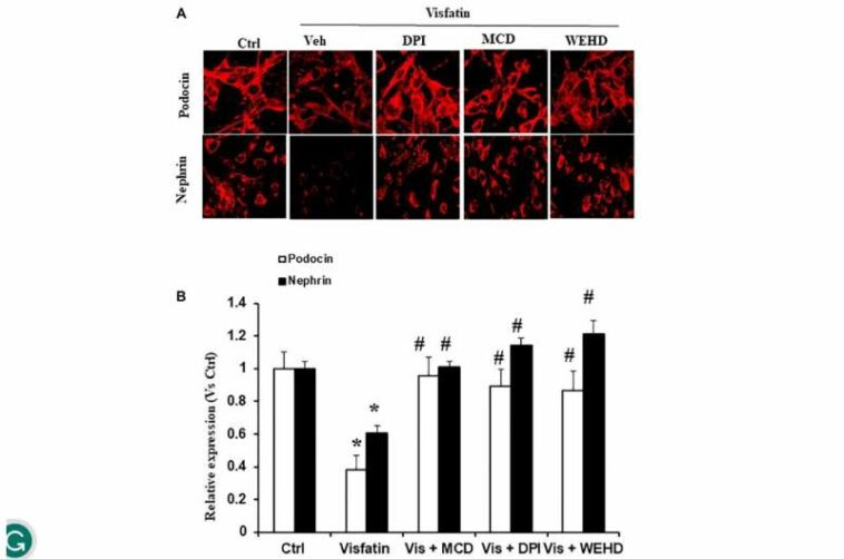 Membrane raft redox signaling contributes to visfatin-induced inflammation and kidney damage