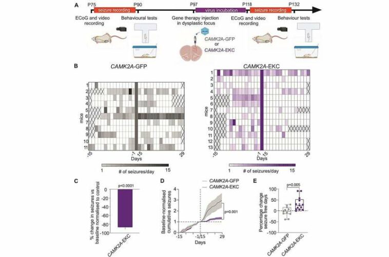 New gene therapy could significantly reduce seizures in severe childhood epilepsy