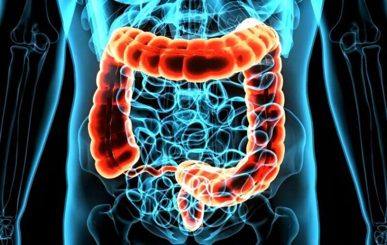 Patient error makes 1 in 10 home colon cancer tests unusable