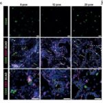 Immune cells shape lung before birth and provide new avenues for treating respiratory diseases