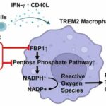 Researchers discover metabolic pathway specific to granuloma formation in patients