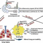 Altering key ion channel protects against pancreatitis-associated acute lung injury