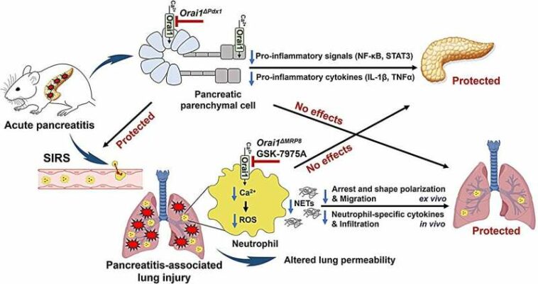 Altering key ion channel protects against pancreatitis-associated acute lung injury