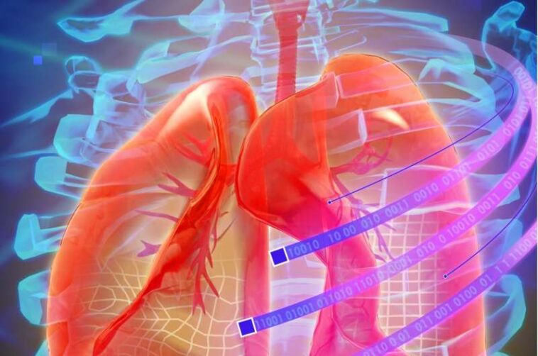 Dlung: a new method for lung image registration