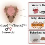 Gender parity in autism research: Synaptic similarities challenge focus on male models