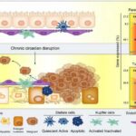 Chronic jet lag leads to human liver cancer in a mouse model