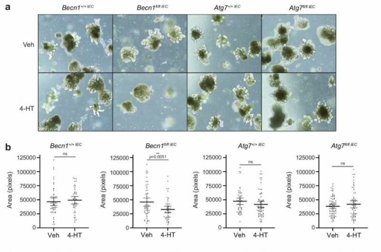 New lead in gut health research