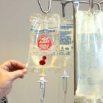 chemotherapy