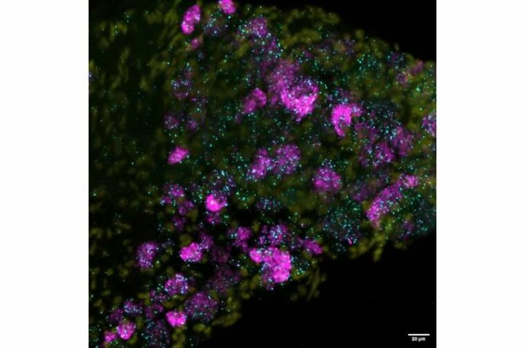 We discovered a 'gentle touch' molecule is essential for light tactile sensation in humans—and perhaps in individual cells