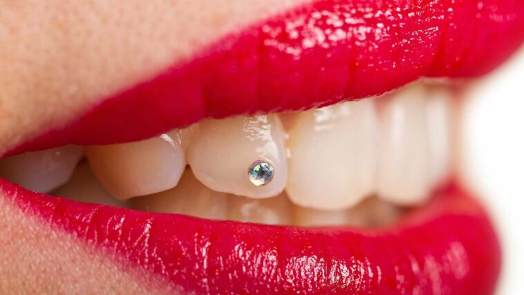 From £35 Crystals to £30,000 Diamonds: The Jaw-Dropping Rise of Tooth Jewellery