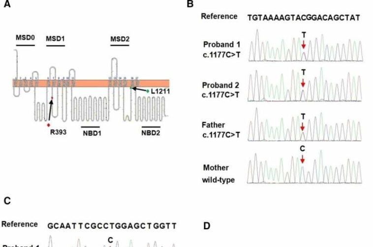 Dubin-Johnson Syndrome in twins linked to novel genetic mutations