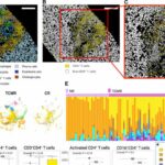 Researchers probe immune microenvironment to prevent pediatric liver transplant rejection