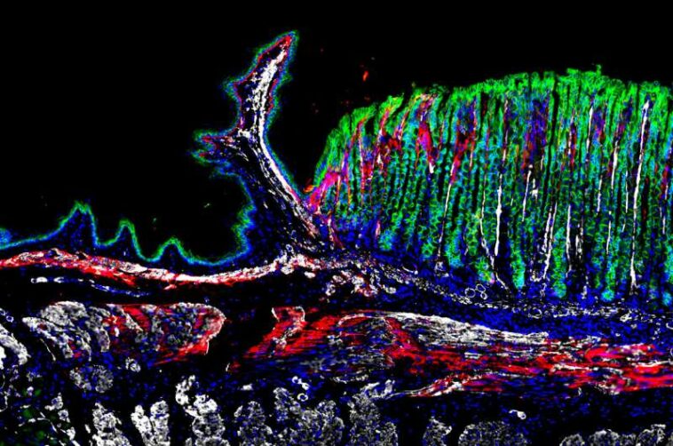 Study lays the basis for new knowledge on gastrointestinal diseases