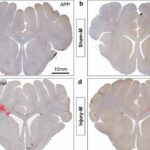 Axons in female mammal brains may be more prone to concussions