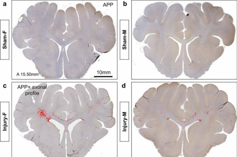 Axons in female mammal brains may be more prone to concussions