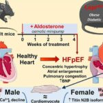 Cause of common type of heart failure may be different for women and men