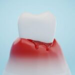 Gum disease can wreak havoc on your sexual health