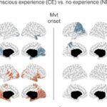 Parasomnia: What happens inside a sleepwalker's brain?