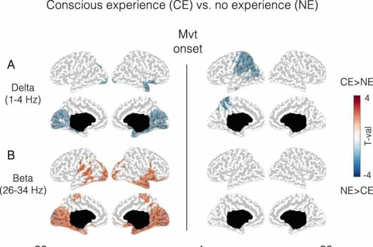 Parasomnia: What happens inside a sleepwalker's brain?