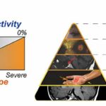 Scientists unravel genetic basis for neurodegenerative disorders that affect vision