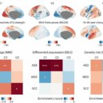 Study links the genetic organisation of healthy brains to autism and schizophrenia