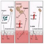 An anti-inflammatory curbs spread of fungi causing serious blood infections