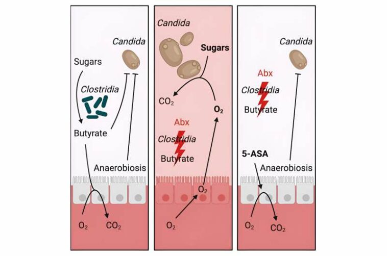 An anti-inflammatory curbs spread of fungi causing serious blood infections