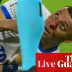 Euro 2024: Kylian Mbappé may miss rest of group games after breaking nose – live