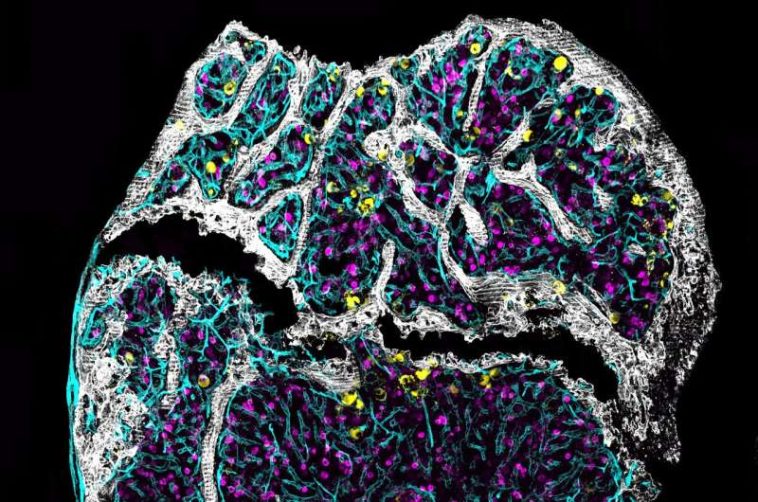 How old is your bone marrow?