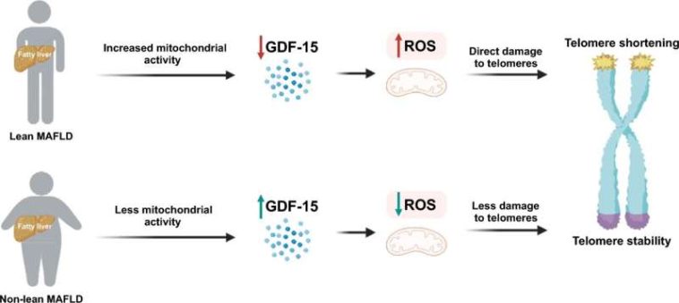 New discovery explains why lean people are more likely to die from MAFLD