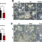 New role of tumor suppressor STAT3β discovered in leukemia