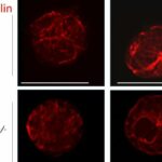 Duke-NUS breakthrough discovery identifies first step in allergic reactions, paving the way for preventative strategies