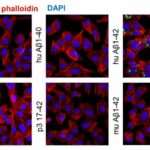 Researchers unravel complexities of Alzheimer's disease in protein fragments and plaque diversity