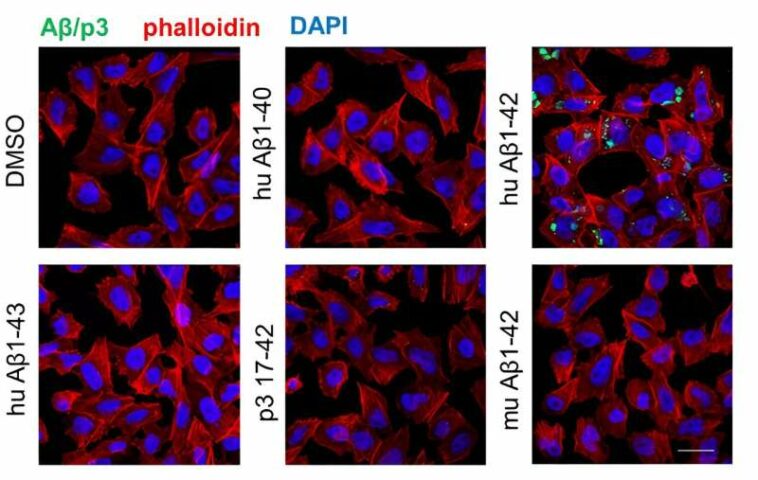 Researchers unravel complexities of Alzheimer's disease in protein fragments and plaque diversity