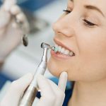 Dental veneers: everything you need to know