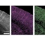 New high-resolution 3D maps show how the brain's blood vessels changes with age