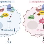 TBC1D1 is an energy-responsive polarization regulator of macrophages via governing ROS production in obesity