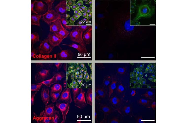 'Dancing molecules' heal cartilage damage