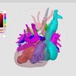 Rady Children's debuts free 3D image viewing software, available for other providers