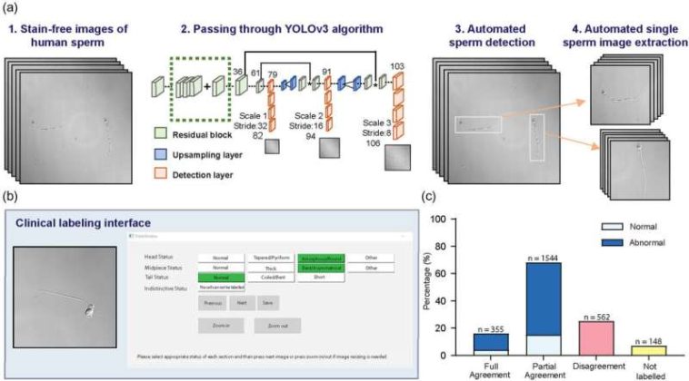 AI sperm checker enhances IVF success