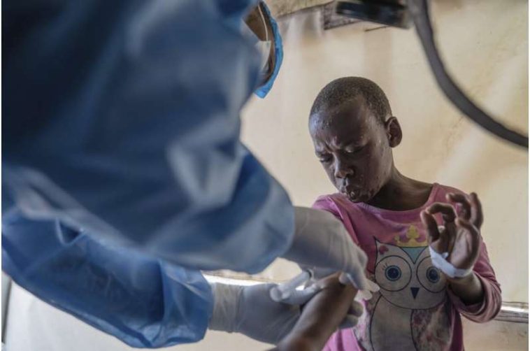 Congo reports more than 1,000 new mpox cases in a week. African authorities ask for vaccines