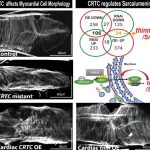 Controlling thickness in fruit fly hearts reveals new pathway for heart disease