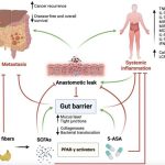 Role of the gut barrier in colorectal cancer treatment