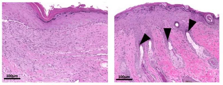 Intestinal parasite could hold key to scar-free wound healing, study suggests