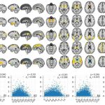 Large-scale brain imaging study reveals five patterns of age-related degeneration