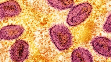 Mpox New Strain Reported in Sweden, Marks the First Case Outside of Africa