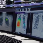 National Healthcare Group adopts AI for lung, heart disease screening