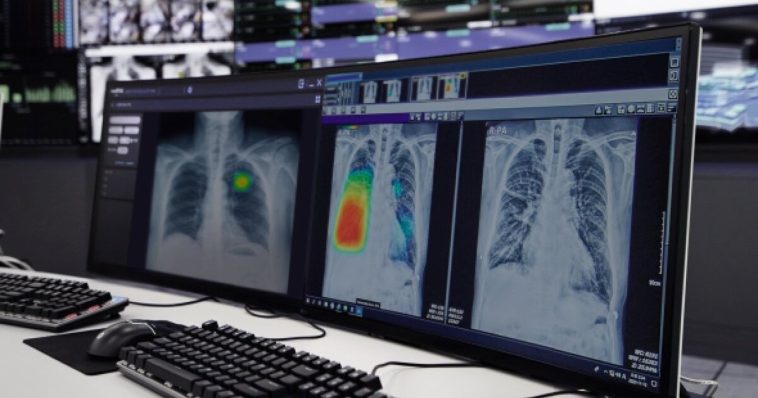 National Healthcare Group adopts AI for lung, heart disease screening